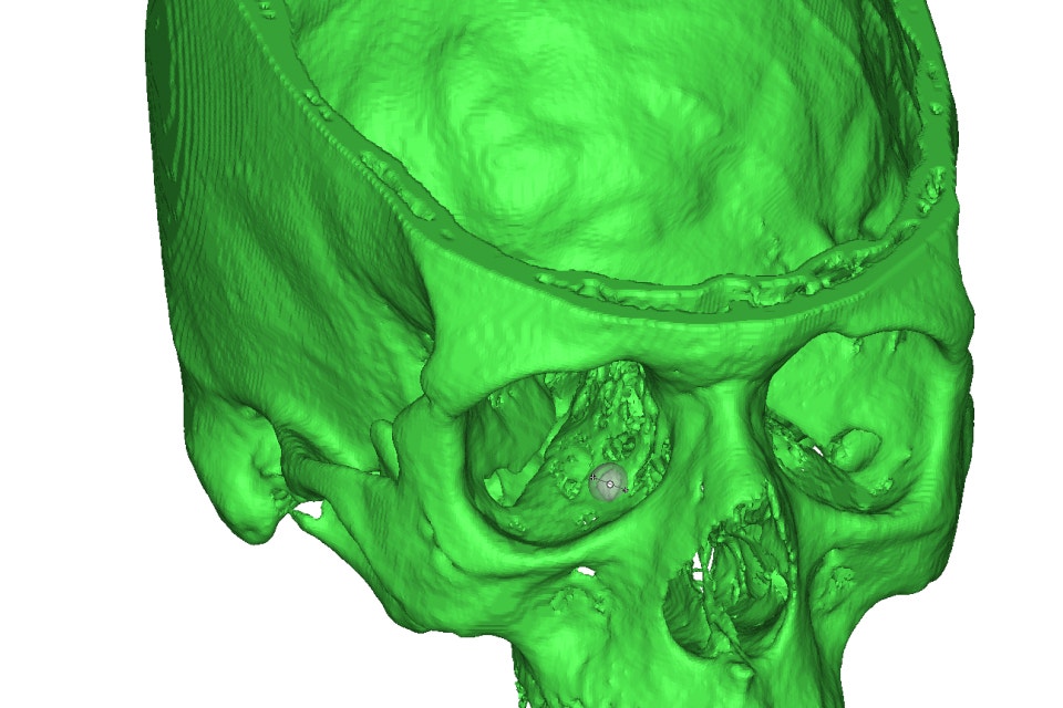 Digital image of a skull in green