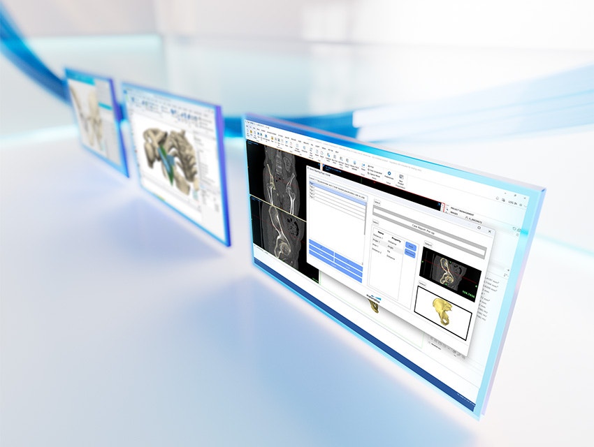 Three screens showing patient anatomy within software from the Materialise Mimics platform on a white reflective background with blue lines