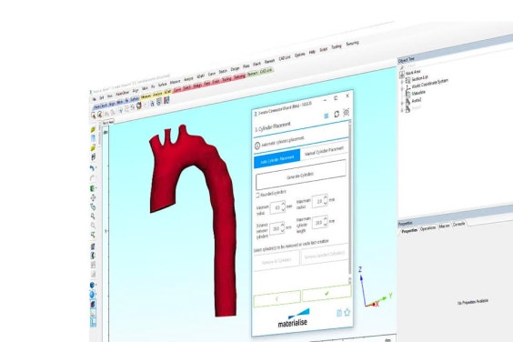 Screenshot der Mimics Innovation Suite, die ein benutzerdefiniertes Plug-In auf einem digitalen anatomischen Modell ausführt