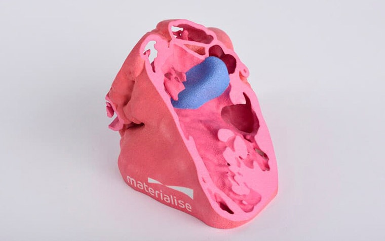 Das Innere eines 3D-gedruckten Herzmodells