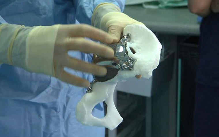 Surgeon handling a 3D-printed hip joint