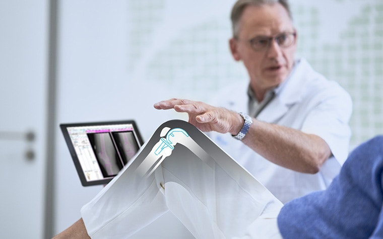 Médecin tenant un ordinateur portable avec le logiciel OrthoView et passant sa main au-dessus du genou d'un patient, mis en évidence par un visuel illustré des os.