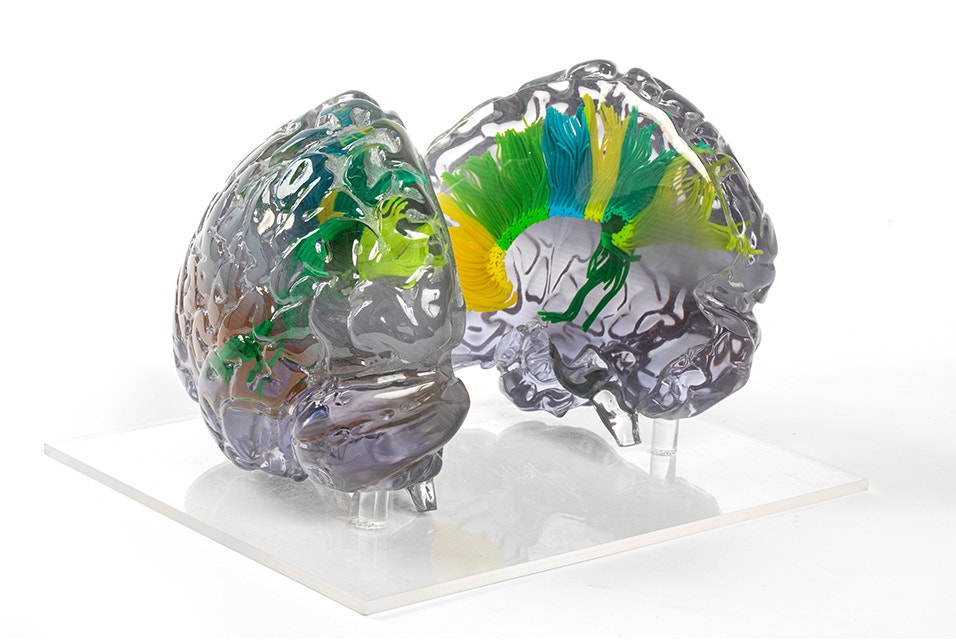 Vue en coupe d'un modèle de cerveau imprimé en 3D, majoritairement transparent avec quelques sections en jaune, vert et bleu