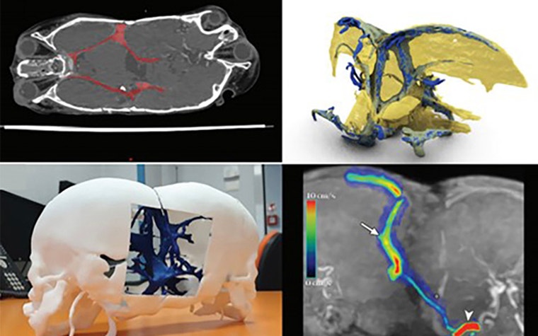 Digital imaging and anatomical models of the conjoined twins 