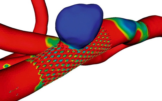 Virtual image of anatomy with a heat map on top