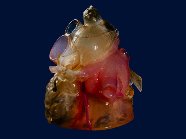 3D-printed anatomical model of a heart