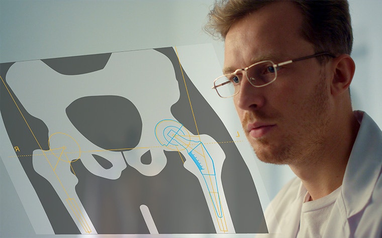 Professionnel médical regardant une projection des os du bassin avec des mesures.
