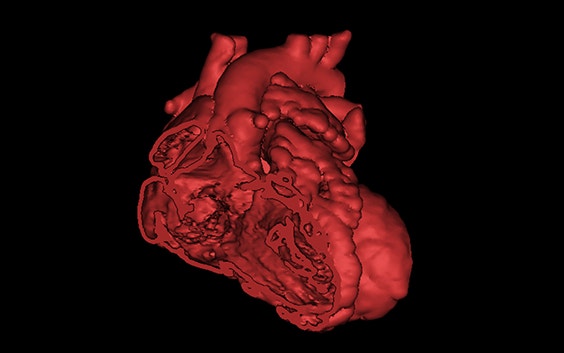 Screenshot of heart in Mimics inPrint