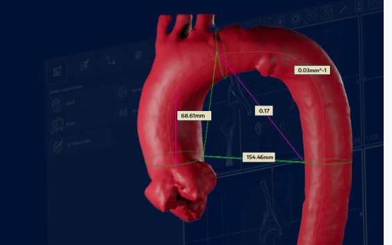 Imagen digital de anatomía con marcas de distancia entre varios puntos