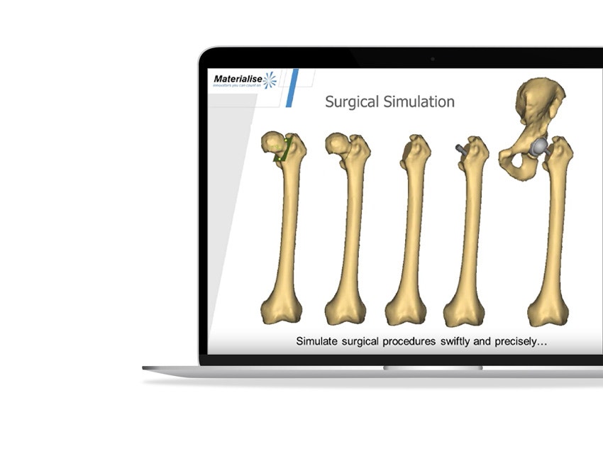 ssd-simulation-surgical-procedures.jpg