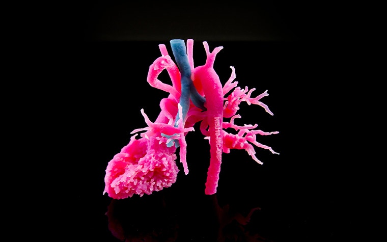 Multi-color 3D-printed anatomical model