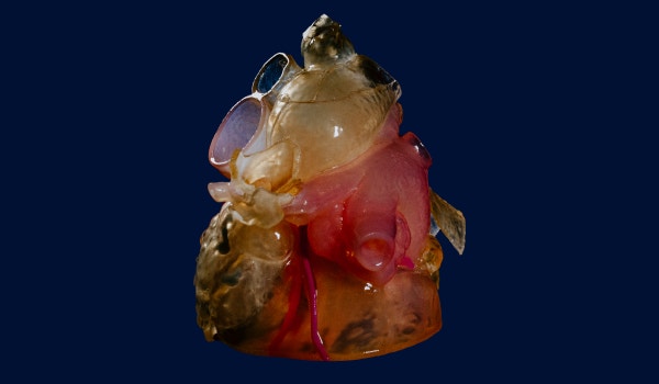 3D-printed anatomical model of a heart