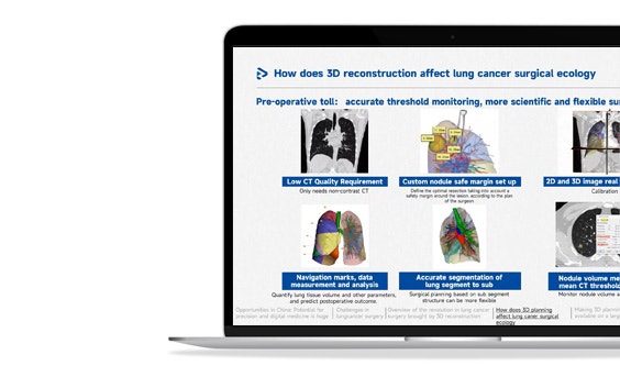 ssm-3d-reconstruction-affect-lung-cancer.jpg