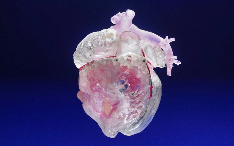 A 3D-printed human heart model 
