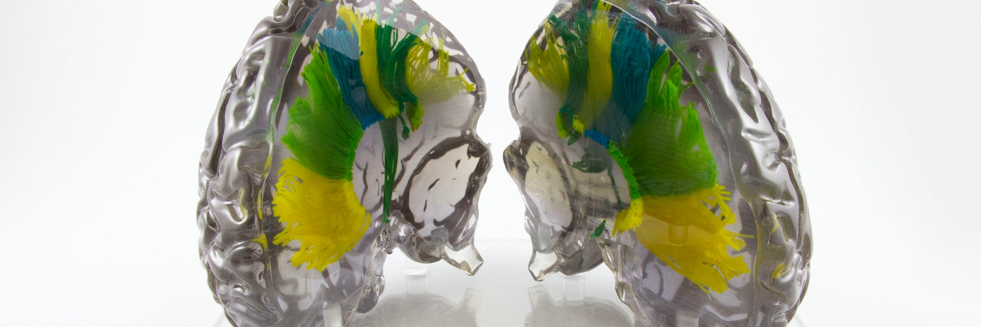 3D-gedrucktes anatomisches Modell des menschlichen Gehirns