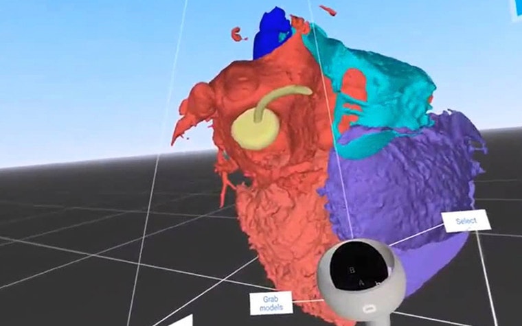 Virtual reality image of the 3D heart model 