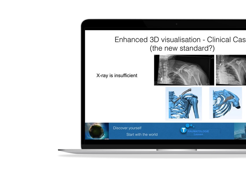 ssd-enhanced-3d-visualisation-clinical-case.jpg