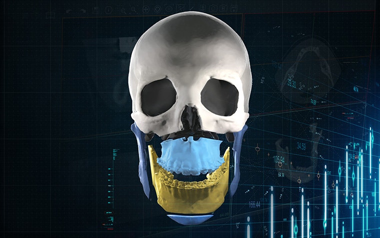 Digital image of a segmented skull