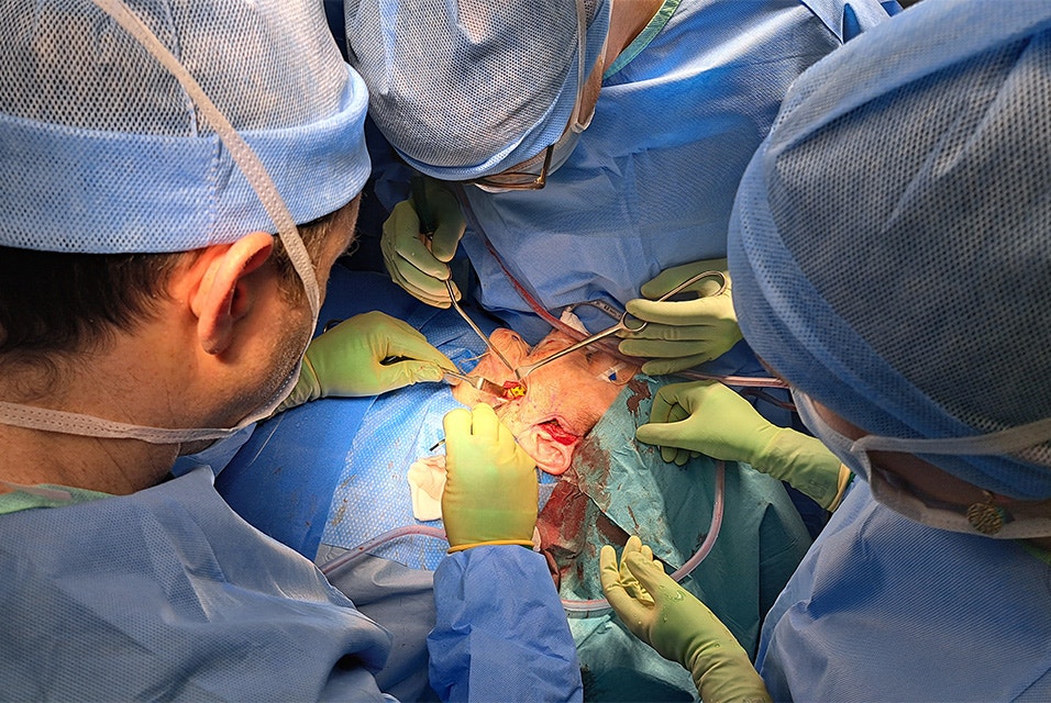 Surgeons fixating a temporal component during TMJ surgery