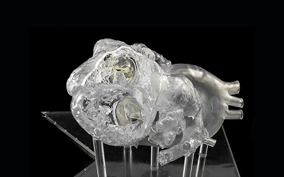 Transparent, 3D-printed heart model on stilt-like structures