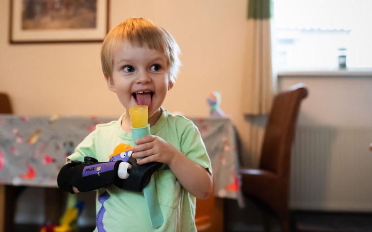 Young child wearing Mitt prosthetic arm, holding an ice lolly