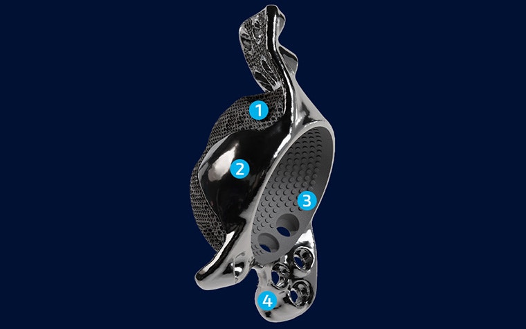 materialise-amace-3d-printed-implant.jpg