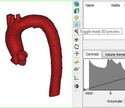 Screenshot of anatomy in Mimics