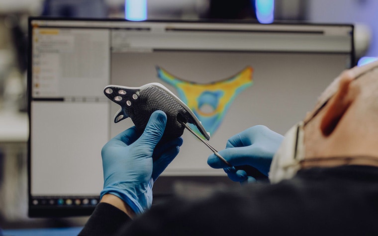 A view over the shoulder of a person wearing latex gloves and using a handheld quality checking tool to assess a 3D-printed medical implant in front of a computer screen showing Materialise software