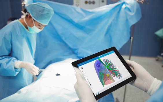 Surgeon reviewing a 3D plan on a tablet during thoracic surgery