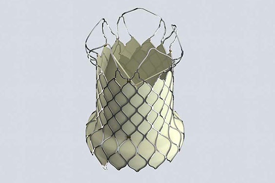 Digital image of heart valve