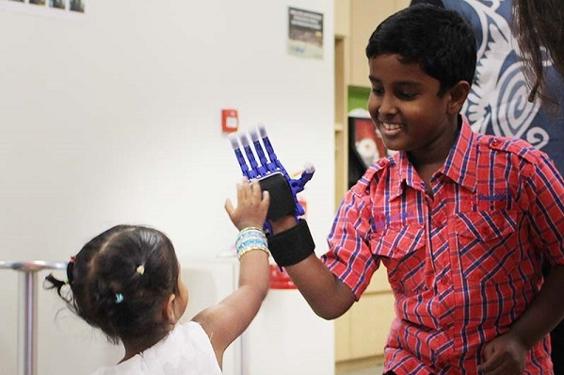 Padmaloshn high fiving with little sister with his prosthetic hand