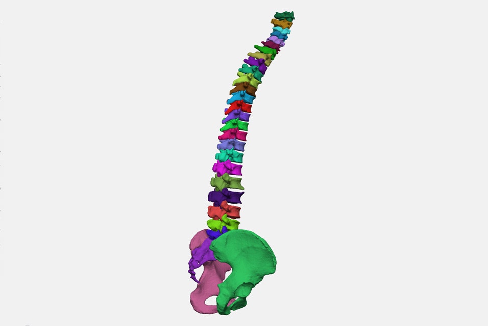 Modelo 3D de la anatomía de una columna vertebral segmentada