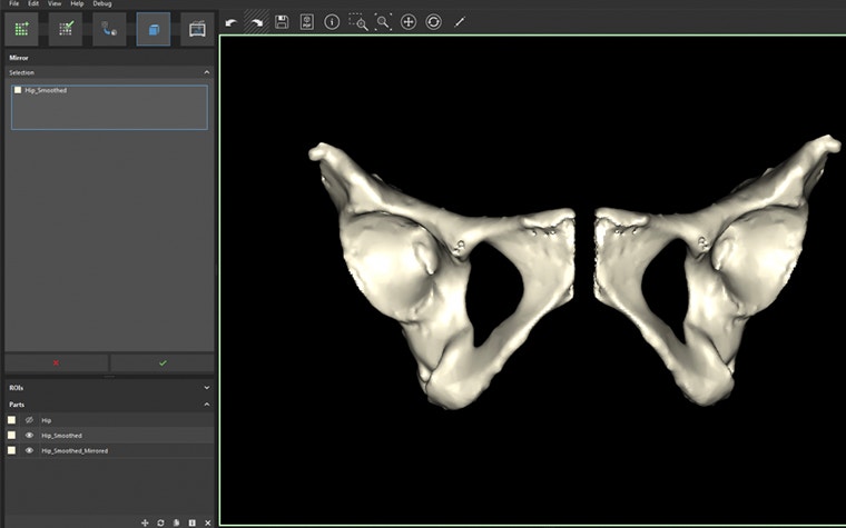 Mirroring hips in medical 3D printing software 