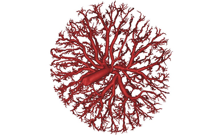 cimq-placental-blood-flow-modeling-3.jpg