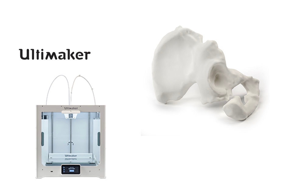 Imprimante 3D Ultimaker à côté d'un modèle de hanche imprimé en 3D