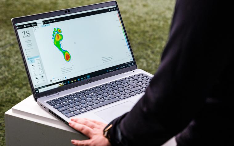 A computer showing the pressure points and forces underneath the foot during gait analysis