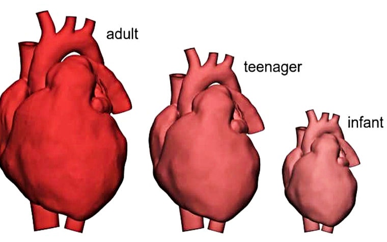 Aus dem annonymisierten Modell eines Erwaschsenenherzens wurden Modelle für Kinderherzen unterschiedlicher Größe erstellt