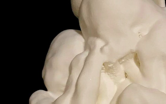 A 3D-printed model of twin fetuses