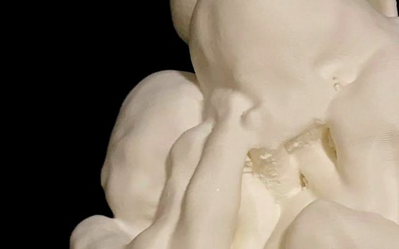 A 3D-printed model of twin fetuses 