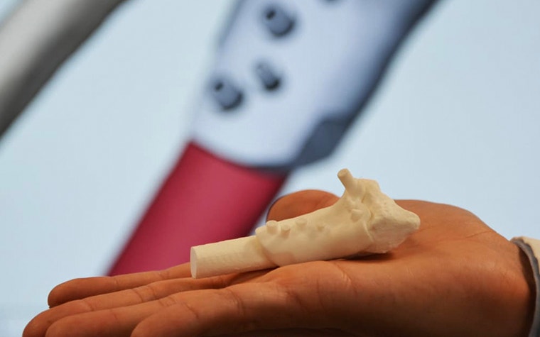 Person holding a 3D-printed surgical guide in front of the digital design 