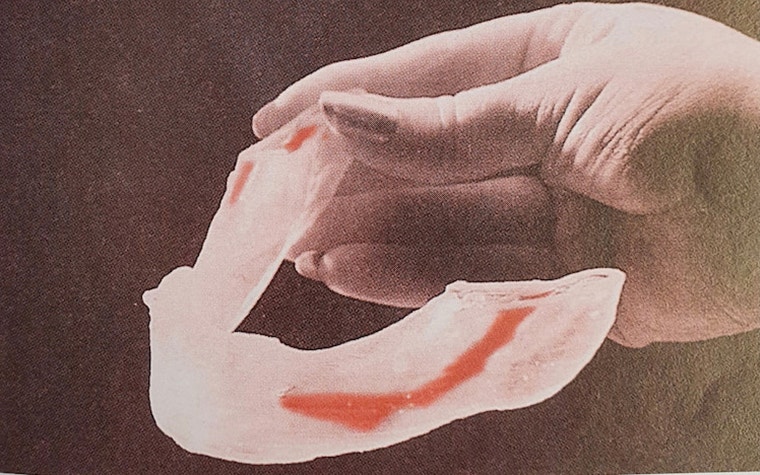 cimq-example-color-stereolithography-3d-anatomical-model-jaw-1996.jpg