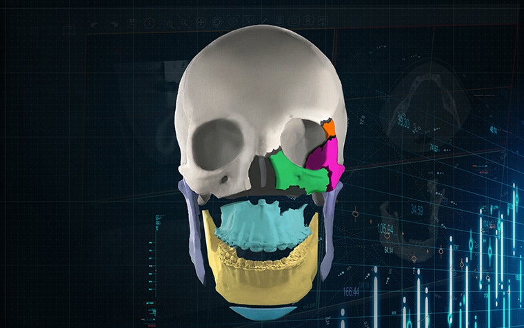 mimics-enlight-cmf-orthognathic-trauma-skull.jpg