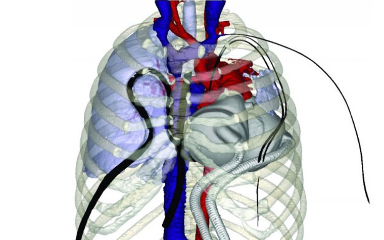 Digital image of a skeleton torso