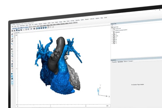3-matic 소프트웨어에 심장 해부 구조를 보여주는 컴퓨터 화면