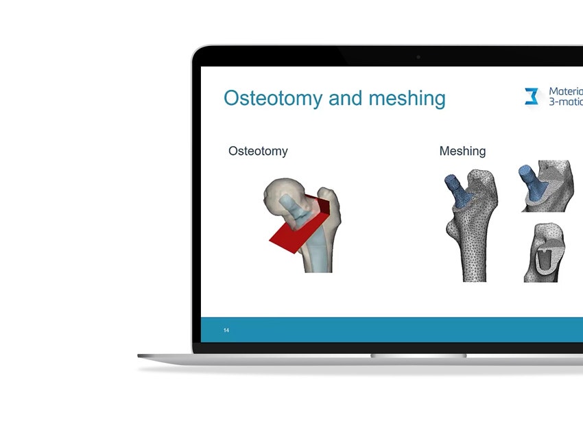 ssd-femur-model-osteotomy-meshing.jpg