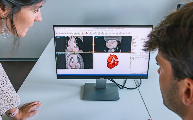 Eine Frau und ein Mann schauen auf einen Computerbildschirm auf einem Tisch, auf dem die Materialise Mimics Software angezeigt wird