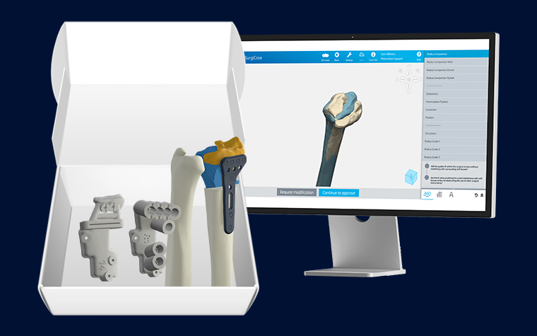 materialise-osteotomies-solutions-personalized-osteotomy-kit.png