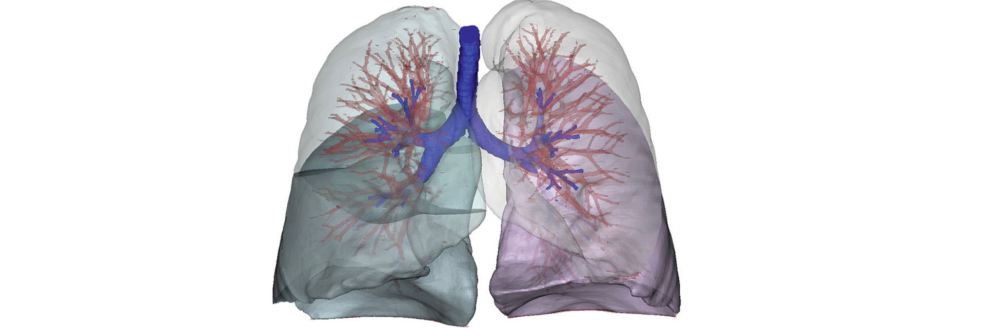 Digital image of lung anatomy