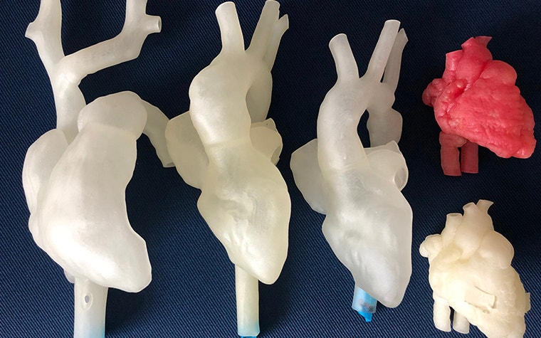 3D-printed heart models of the LMU Hospital 