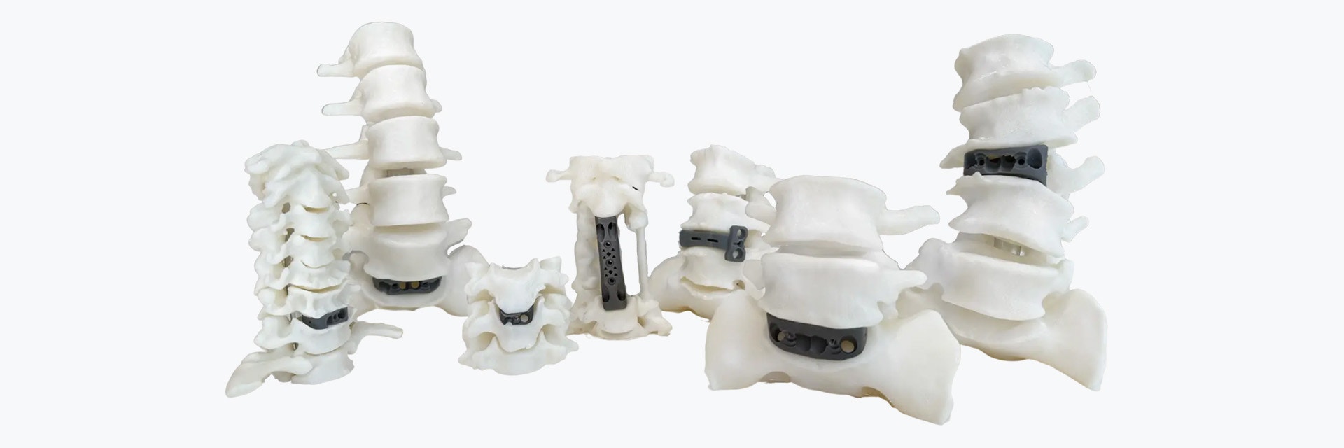 各インプラントには、3Dプリントされた解剖学的モデルまたはバイオモデルを供給することができ、外科医は患者固有の正確なレプリカを使用して手術を行うことができる。